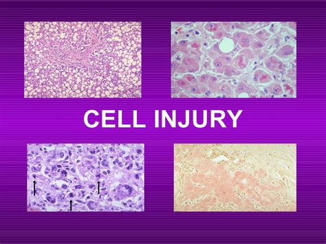 of Pathology. . Cell injury pathology ppt